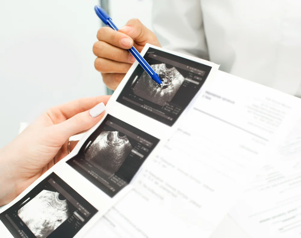 échographies - Vers l'essentiel